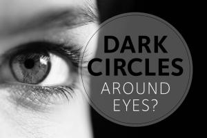 Dark circles around eyes.