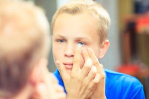 boy inserting contact lens.