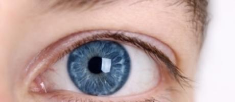 keratoconus